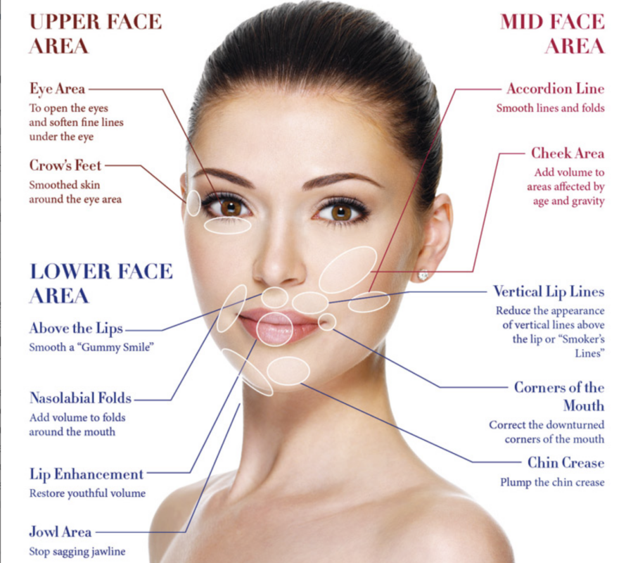 Dermalfiller Ascend Skin Clinics